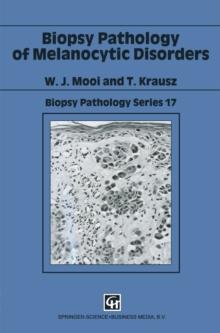 Biopsy Pathology of Melanocytic Disorders