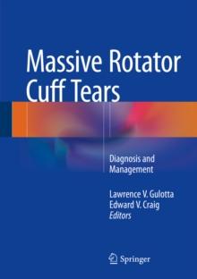 Massive Rotator Cuff Tears : Diagnosis and Management