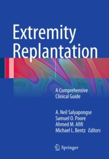 Extremity Replantation : A Comprehensive Clinical Guide