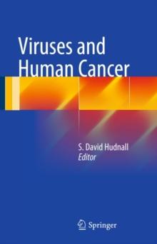 Viruses and Human Cancer