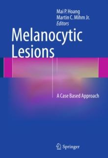 Melanocytic Lesions : A Case Based Approach