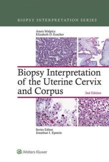 Biopsy Interpretation of the Uterine Cervix and Corpus