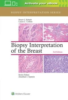 Biopsy Interpretation Of The Breast