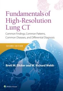 Fundamentals of High-Resolution Lung CT : Common Findings, Common Patterns, Common Diseases and Differential Diagnosis