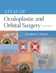 Atlas of Oculoplastic and Orbital Surgery