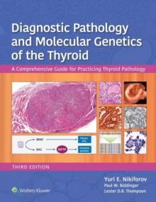 Diagnostic Pathology and Molecular Genetics of the Thyroid : A Comprehensive Guide for Practicing Thyroid Pathology