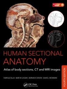 Human Sectional Anatomy : Atlas of Body Sections, CT and MRI Images, Fourth Edition