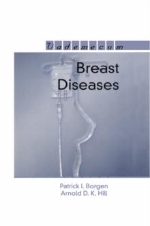 Breast Diseases