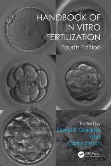 Handbook of In Vitro Fertilization