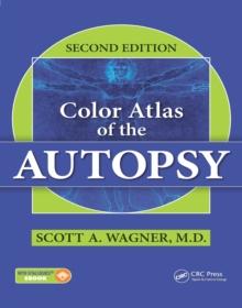 Color Atlas of the Autopsy