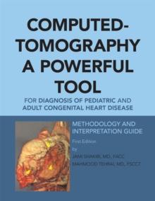 Computed-Tomography a Powerful Tool for Diagnosis of Pediatric and Adult Congenital Heart Disease : Methodology and Interpretation Guide