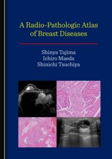 A Radio-Pathologic Atlas of Breast Diseases