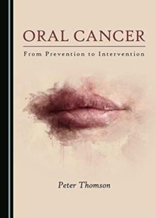 Oral Cancer : From Prevention to Intervention