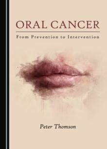 None Oral Cancer : From Prevention to Intervention