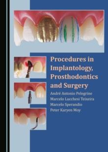 None Procedures in Implantology, Prosthodontics and Surgery