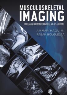 Musculoskeletal Imaging : 100 Cases (Common Diseases) US, CT and MRI