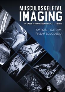 Musculoskeletal Imaging