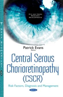 Central Serous Chorioretinopathy (CSCR) : Risk Factors, Diagnosis and Management