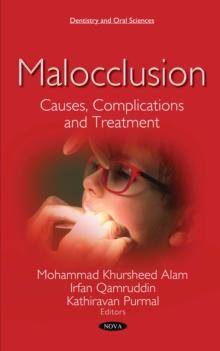 Malocclusion : Causes, Complications and Treatment