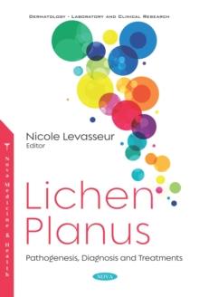 Lichen Planus: Pathogenesis, Diagnosis and Treatments