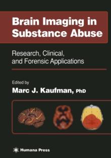 Brain Imaging in Substance Abuse : Research, Clinical, and Forensic Applications