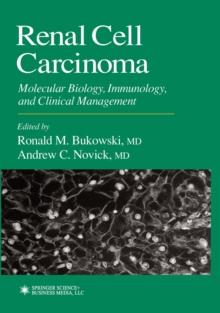 Renal Cell Carcinoma : Molecular Biology, Immunology, and Clinical Management