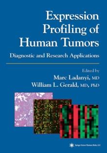 Expression Profiling of Human Tumors : Diagnostic and Research Applications