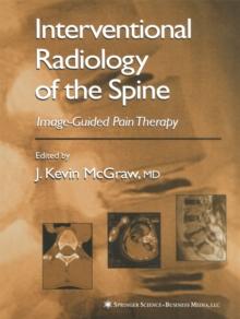 Interventional Radiology of the Spine : Image-Guided Pain Therapy