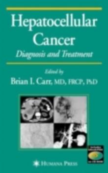 Hepatocellular Carcinoma : Diagnosis and Treatment