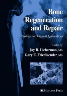 Bone Regeneration and Repair : Biology and Clinical Applications