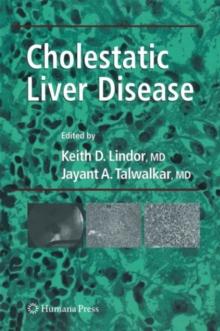 Cholestatic Liver Disease