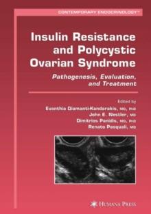 Insulin Resistance and Polycystic Ovarian Syndrome : Pathogenesis, Evaluation, and Treatment