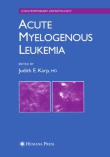 Acute Myelogenous Leukemia