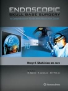 Endoscopic Skull Base Surgery : A Comprehensive Guide with Illustrative Cases