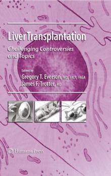 Liver Transplantation : Challenging Controversies and Topics