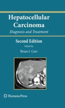 Hepatocellular Carcinoma : Diagnosis and Treatment