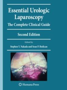 Essential Urologic Laparoscopy : The Complete Clinical Guide