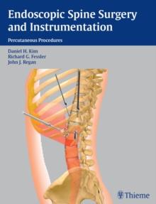 Endoscopic Spine Surgery and Instrumentation