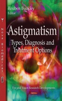 Astigmatism : Types, Diagnosis and Treatment Options