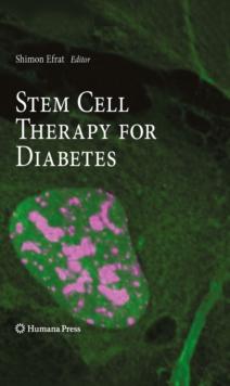 Stem Cell Therapy for Diabetes