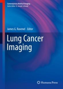 Lung Cancer Imaging