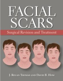 Facial Scars : Surgical Revision and Treatment