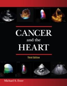 Cancer and the Heart