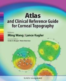 Atlas and Clinical Reference Guide for Corneal Topography