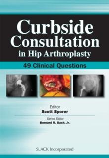 Curbside Consultation in Hip Arthroplasty : 49 Clinical Questions