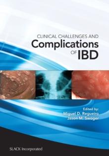 Clinical Challenges and Complications of IBD