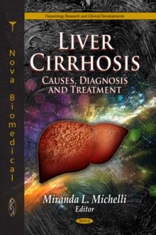 Liver Cirrhosis : Causes, Diagnosis and Treatment