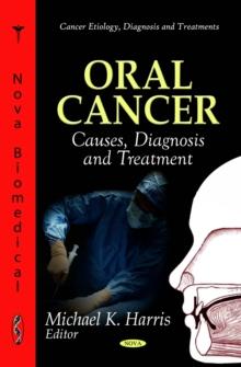 Oral Cancer : Causes, Diagnosis and Treatment