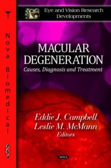 Macular Degeneration : Causes, Diagnosis and Treatment