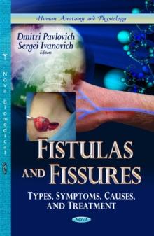 Fistulas and Fissures : Types, Symptoms, Causes, and Treatment